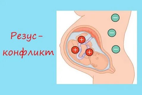 Как влияют разные резусы на беременность