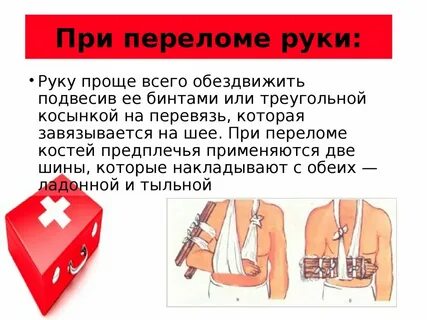 Первая помощь при переломе руки ноги