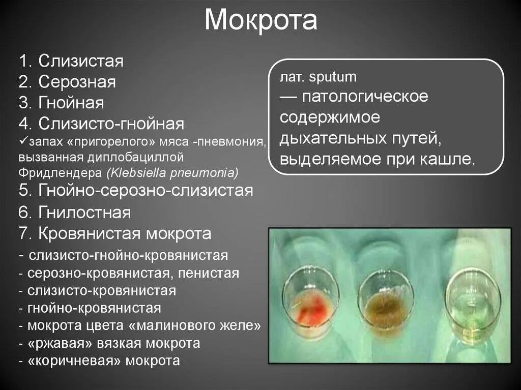 Запах гнойной мокроты. Гнойно слизистая мокрота. Цвет мокроты и заболевания.