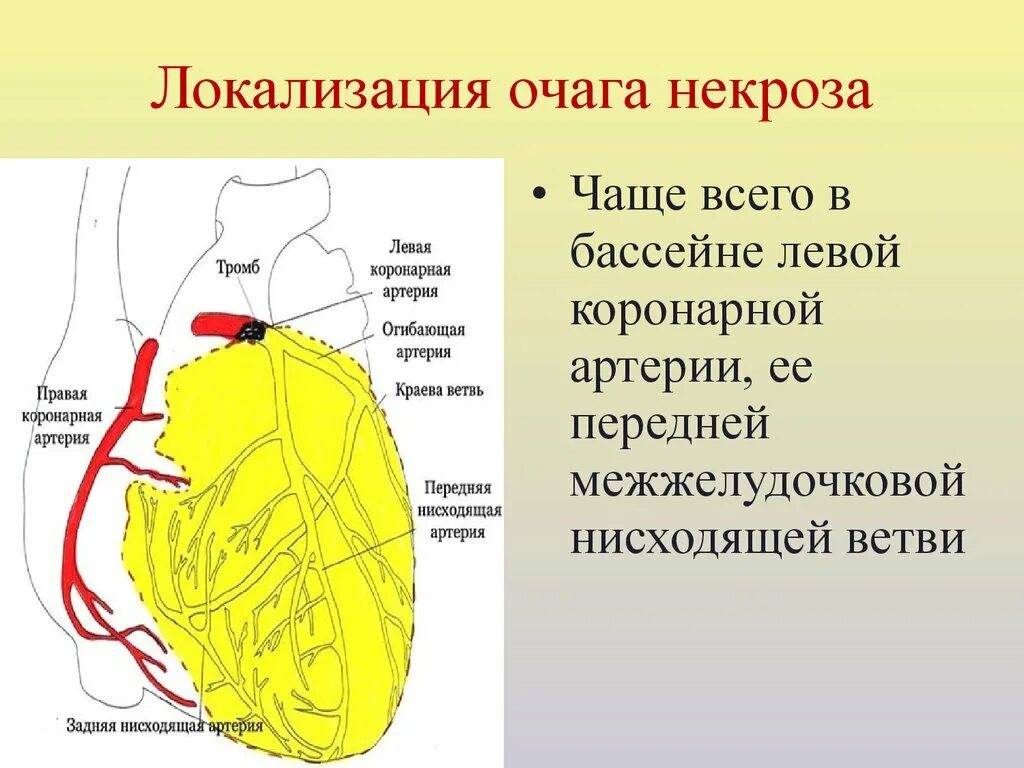 Коронарные артерии кровоснабжают. Ветви левой венечной артерии. Передняя межжелудочковая ветвь левой коронарной артерии. Коронарная артерия левой передней нисходящей ветви. Межжелудочковая ветвь левой венечной артерии.