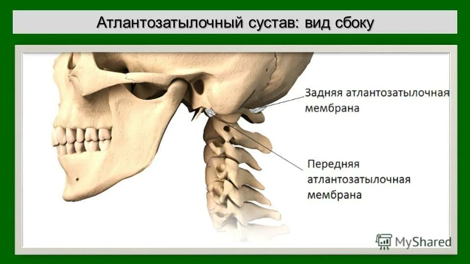 Соединения позвонков атланто-затылочный сустав анатомия. Атланто затылочный сустав строение. Какой позвонок соединяется с черепом. Связки атланто затылочного сустава анатомия. Какой позвонок соединяется с черепом.