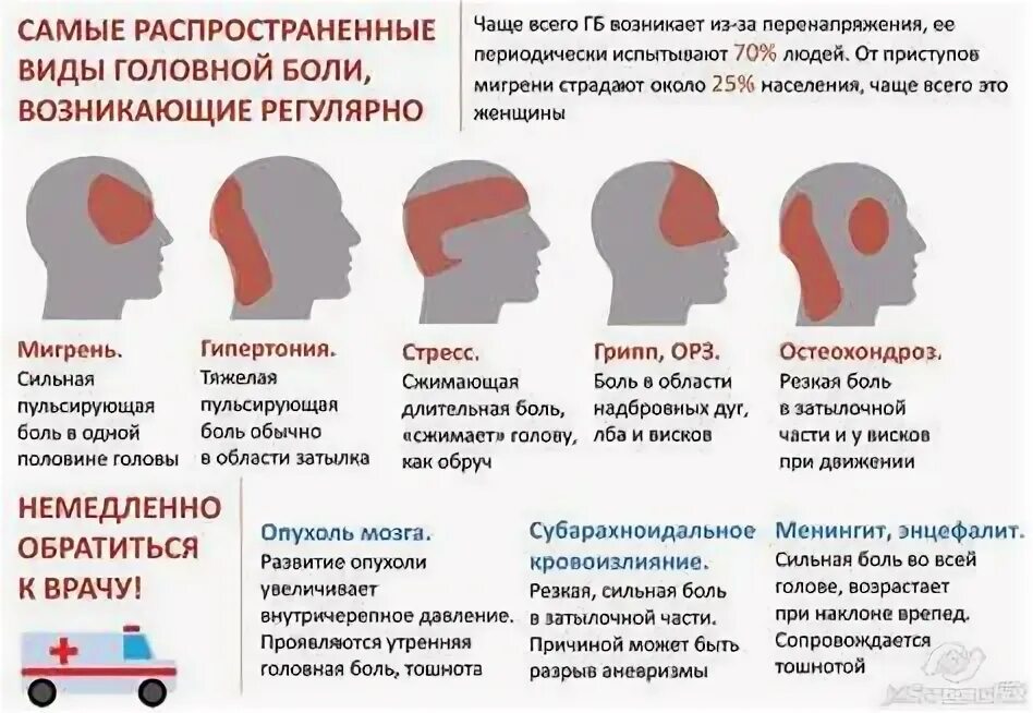 Причины головной боли. Профилактика мигрени у детей. Частые головные боли при беременности. Частые головные боли при беременности. Головная боль при беременности на ранних.