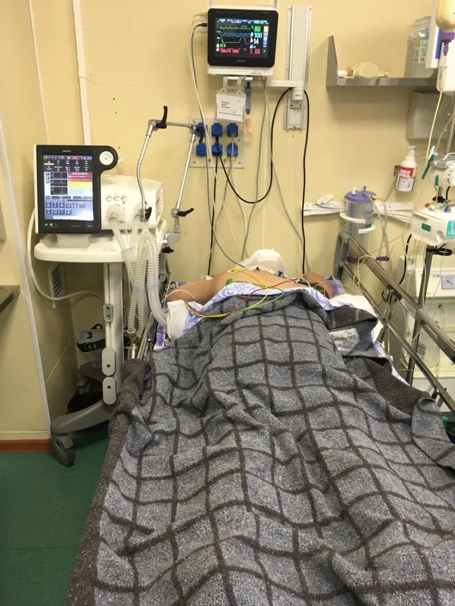 В сознании ли человек в реанимации. Аппарат ивл коронавирус реанимация. В сознании ли человек в реанимации. Смерть в реанимации в больнице. Аппарат искусственного дыхания.