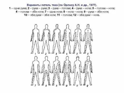 Некоторые варианты