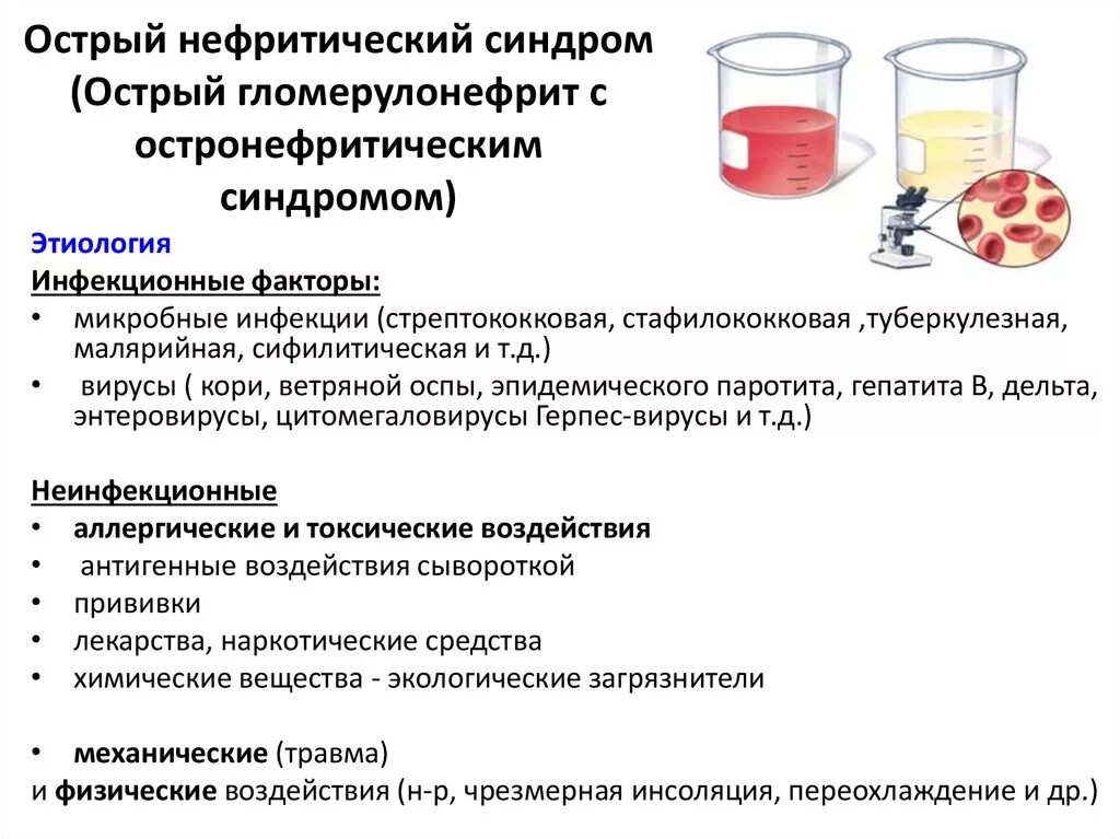 Нефритический синдром при остром гломерулонефрите. Гломерулонефрит с нефритическим синдромом. Острый нефритический синдром препараты. Нефритический синдром симптоматика. Изменения в моче при гломерулонефрите