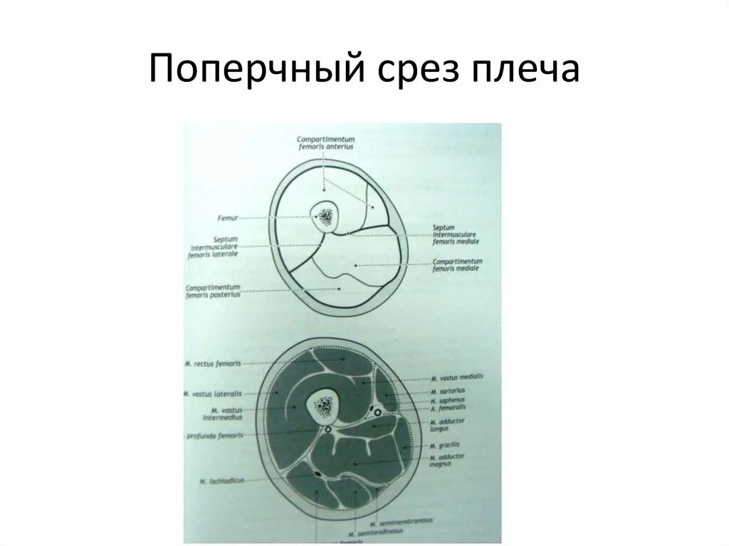 Топографические срезы. Поперечный срез плеча в средней трети. Схема поперечного среза плеча. Срезы плеча топографическая анатомия. Поперечный распил плеча 3 уровня схема.