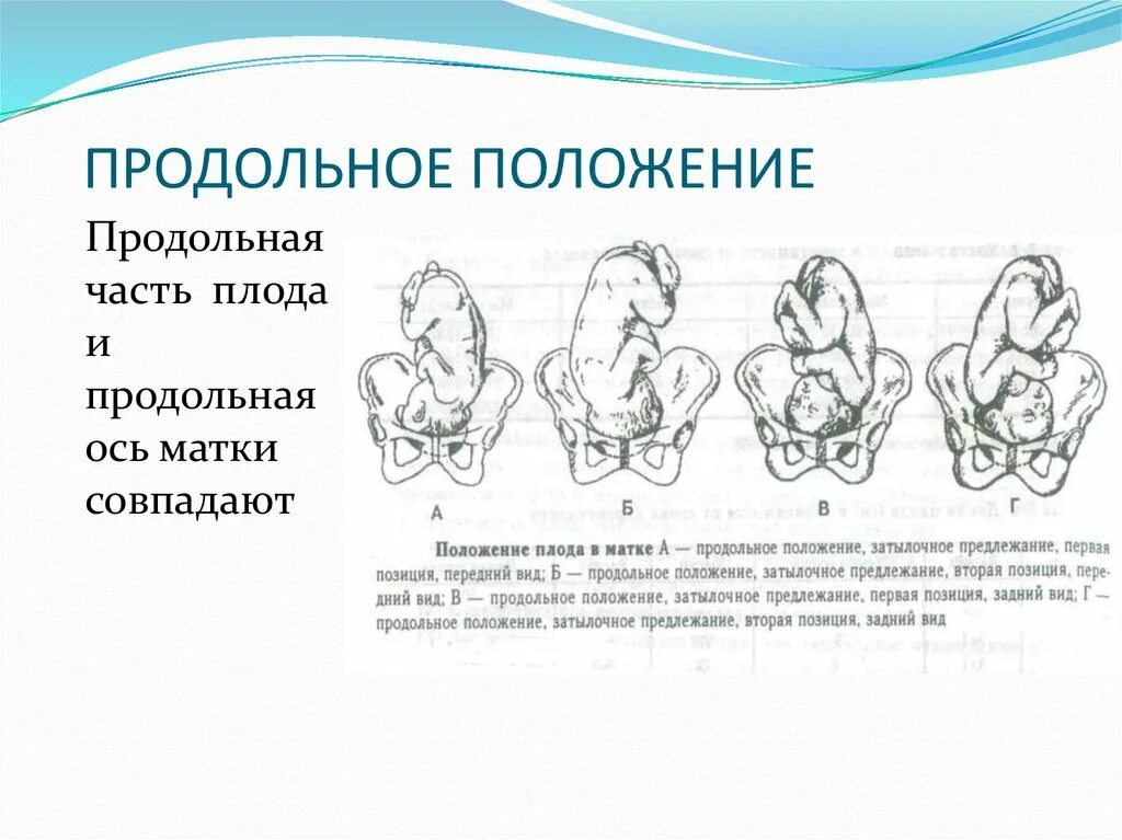 Что означает предлежание. Положение плода продольное головное 2 позиция. Положение плода продольное предлежание головное. Положение плода продольное тазовое 1 позиция. Продольное положение тазовое предлежание 30 недель.