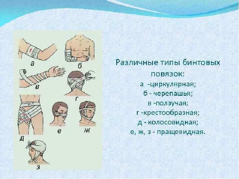 Основные типы повязок. Типы бинтовых повязок. Различные типы бинтовых повязок. Типовые бинтовые повязки. Бинтовые повязки наложения повязок.