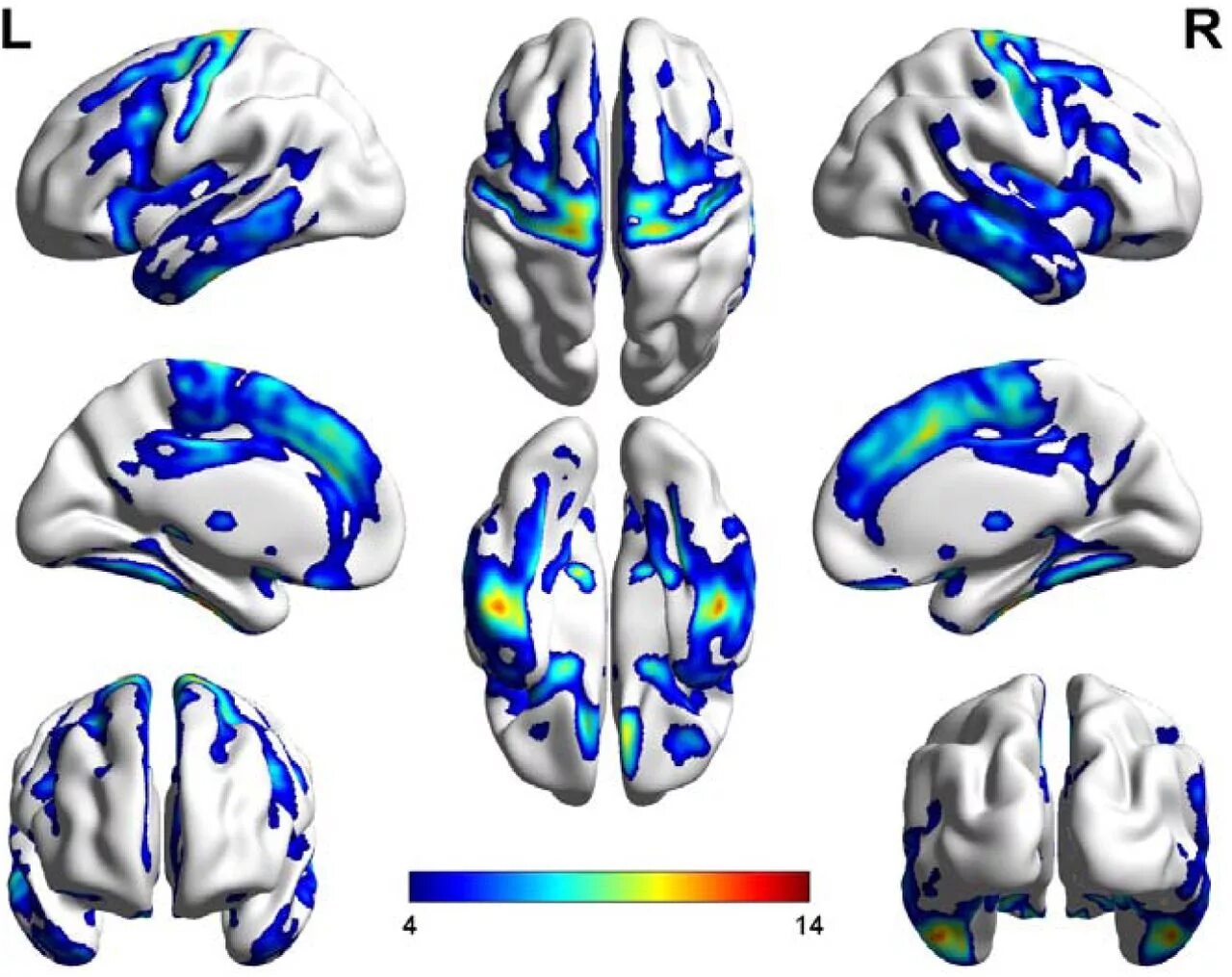 ФМРТ. FMRI data. ФМРТ С заданием. ФМРТ картинки. Brain imaging