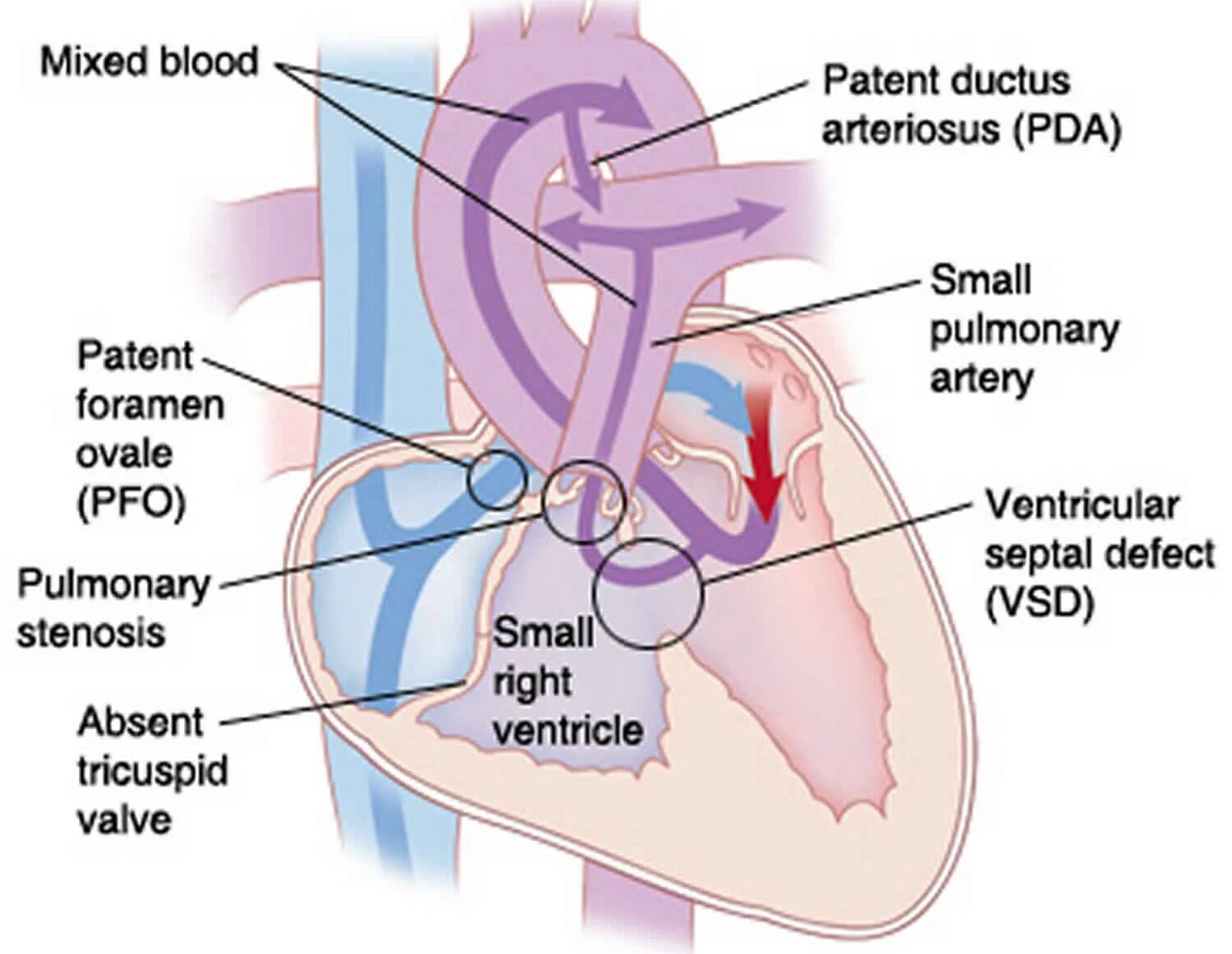 Plexus arteriosus