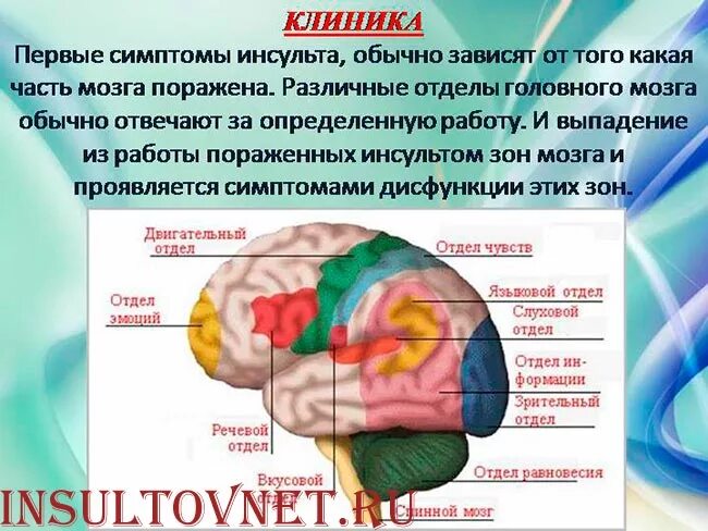Инсульт зоны поражения головного мозга. Инсульт долей головного мозга. Поражение правого полушария мозга