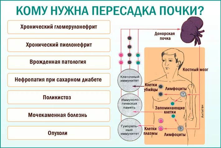 Трансплантация почки этапы. Этапы трансплантации почки хирургия. Трансплантация почки этапы операции. Пересадка почки в москве