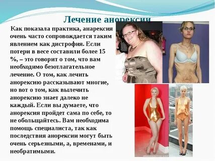 Анорексия что это такое простыми