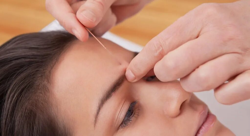 Иглорефлексотерапия акция. Акупунктура отзывы. Акупунктура отзывы. Реклама иглорефлексотерапии. Акупунктура отзывы.