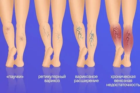 Венозная эстетическая