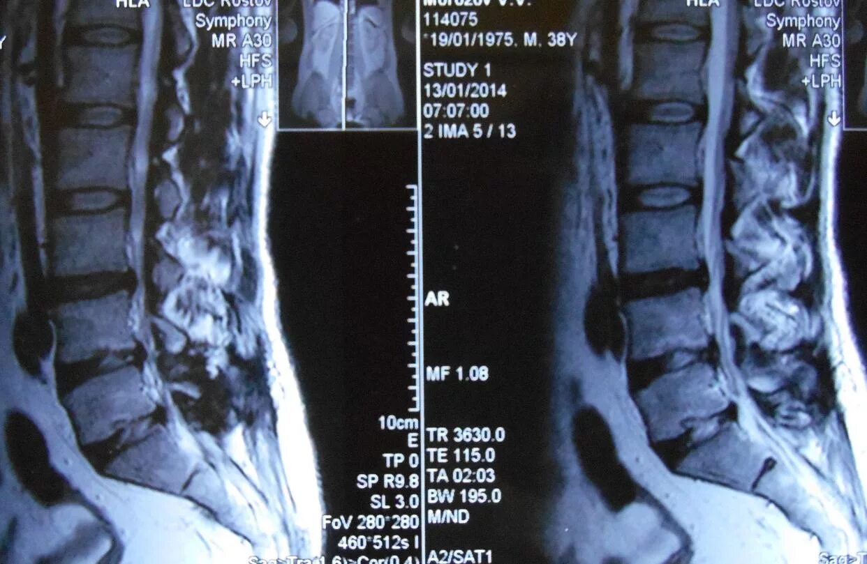 Backache treatment - Lahore Chiroprator Clinic