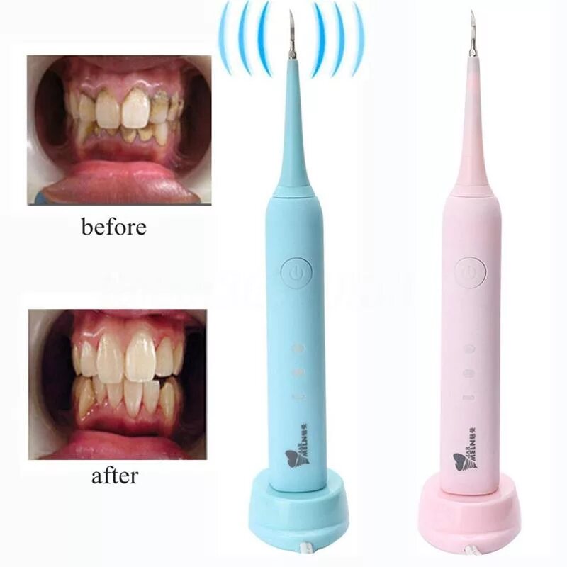 Как называется инструмент для чистки зубов ультразвуком. Зубная электрическая щетка Dental Tools.