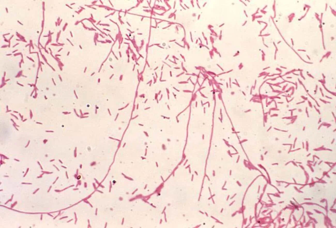 Грамм отрицательные палочки в мазке. Legionella pneumophila морфология. грамотрицательные палочки легионеллы. legionella pneumophila окраска по граму. легионелла возбудитель.