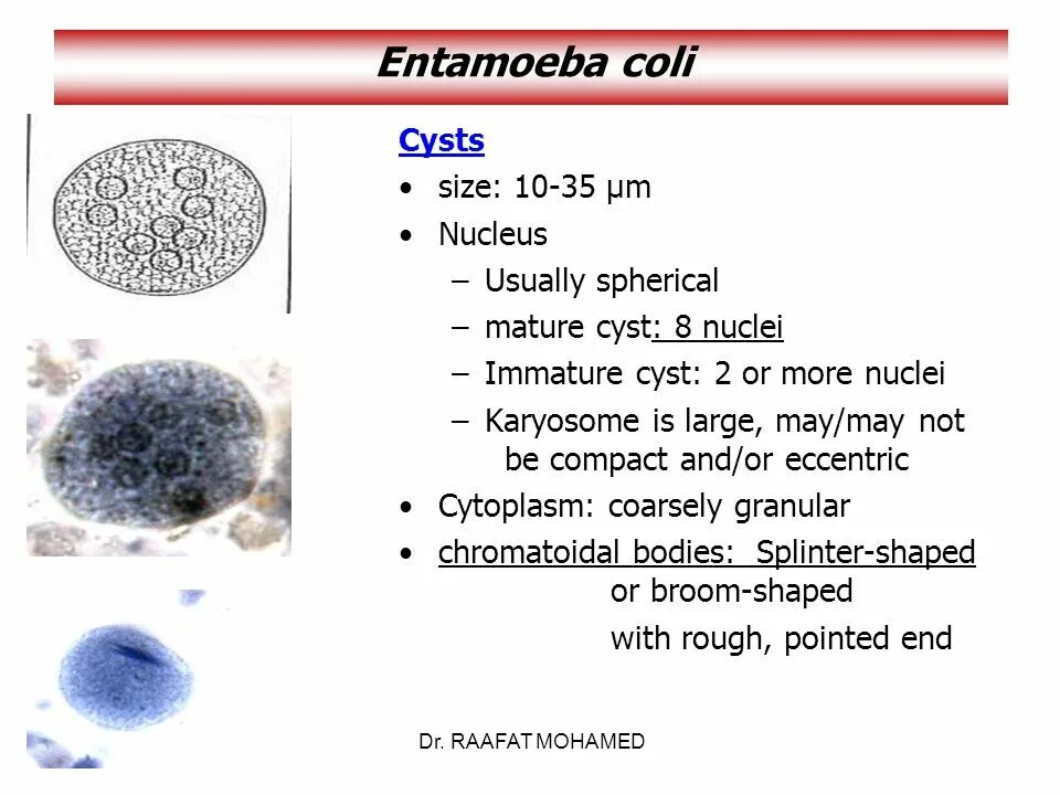 Цисты Entamoeba. Entamoeba coli циста. Entamoeba coli циста строение. Цисты энтамеба коли. Entamoeba coli в кале