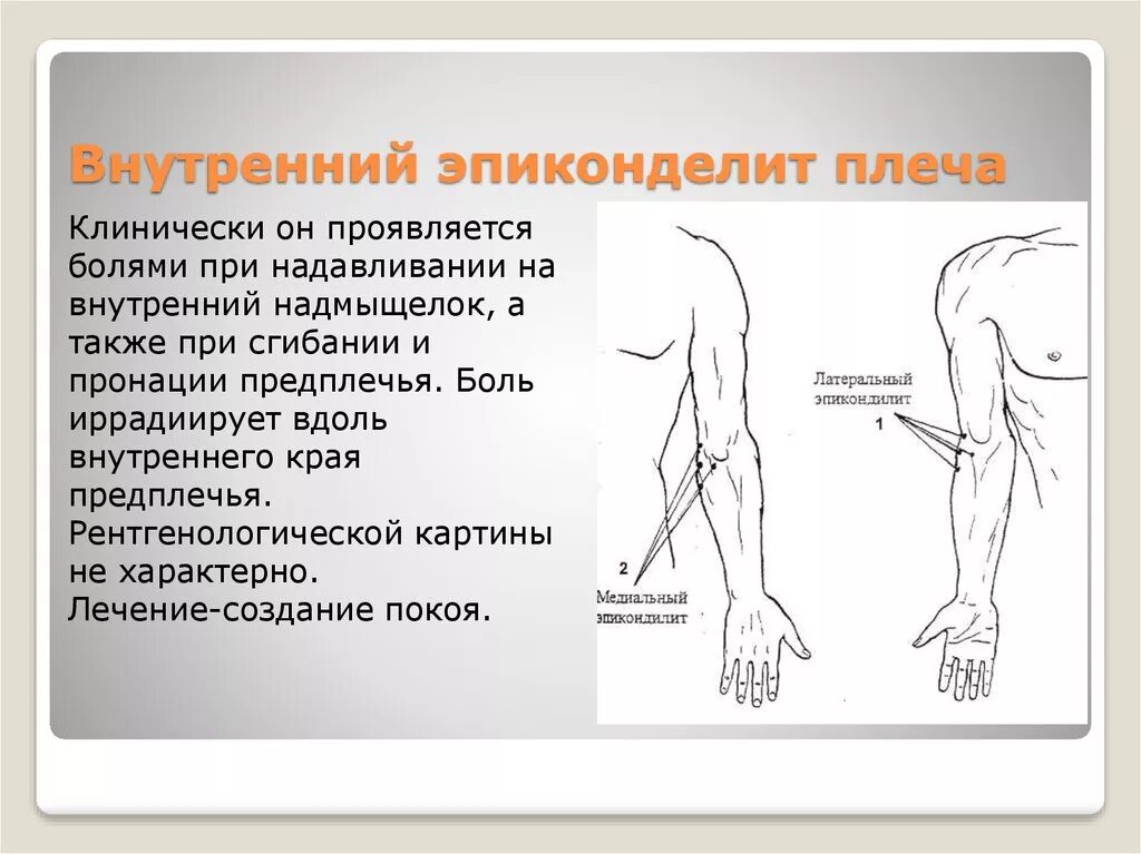 Болит левая сторона рука плечо