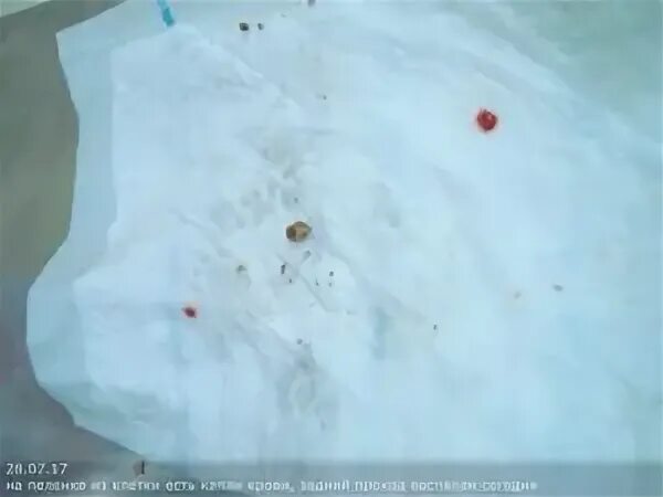 Выкидыш на поздних сроках беременности: причины, последствия, врачебная тактика