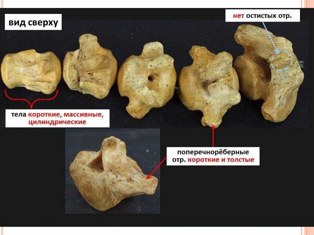 Особенности шейных позвонков птиц. Хвостовые позвонки. Хвостовые позвонки животных. Хвостовые позвонки КРС. Хвостовой позвонок анатомия.