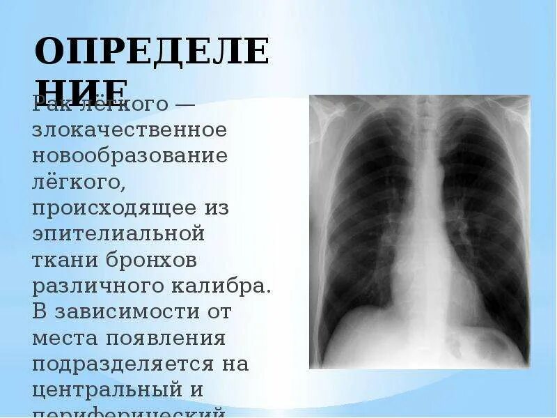 Злокачественное образование в легких. Центральная опухоль легкого. Новообразование бронхов и легкого. Образование легких неуточненное