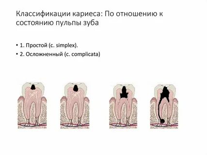 Пульпы классификации