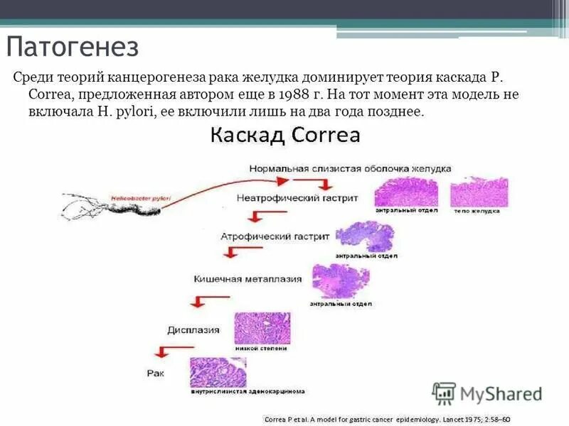 патогенез заболеваний пищевода. этиология новообразований желудка. опухоли желудка этиология. патогенез. патогенез рака желудка.