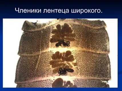 Широкий лентец под микроскопом