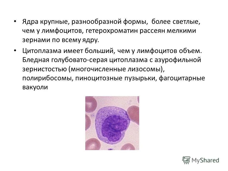 лимфоциты гистология. ядро лимфоцитов. лимфоциты строение гистологическое. малый лимфоцит. лимфоциты ядро.