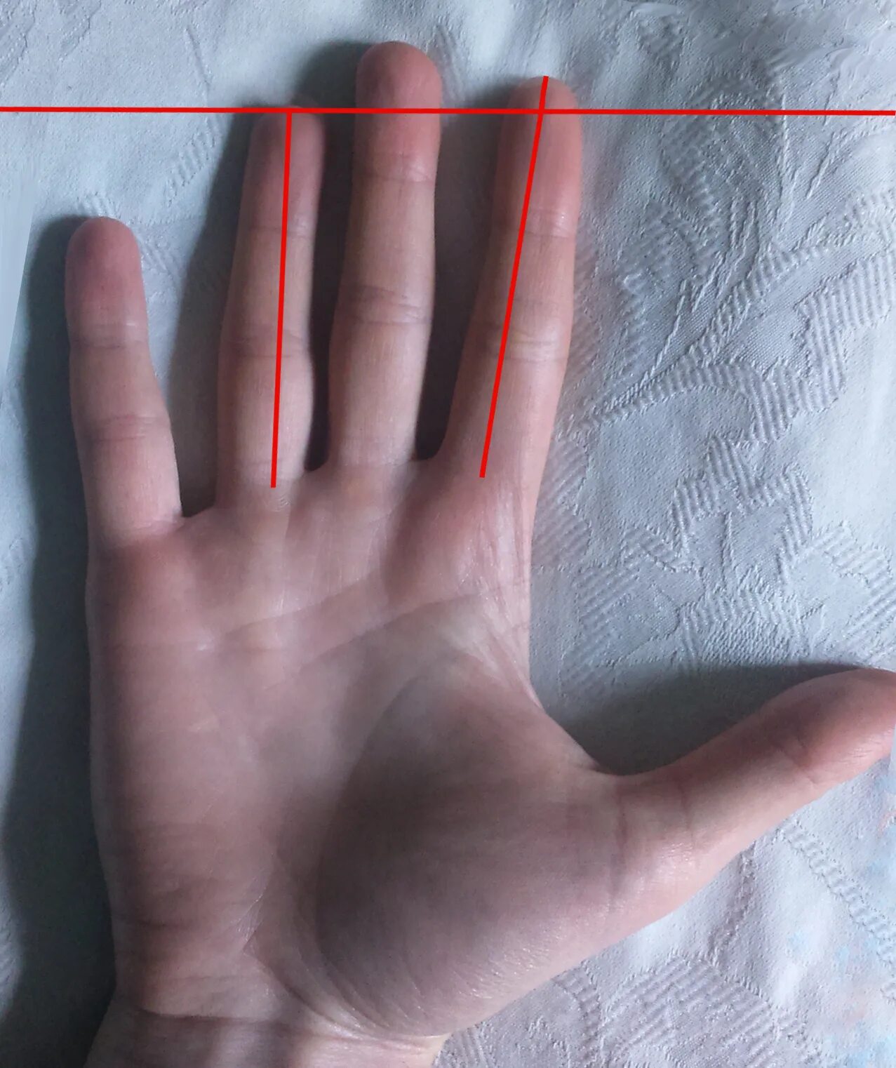 Сколько сантиметров пальцы. Маленький мизинец на руке. Безымянный палец на руке. Правильные руки. Длинный большой палец на руке.