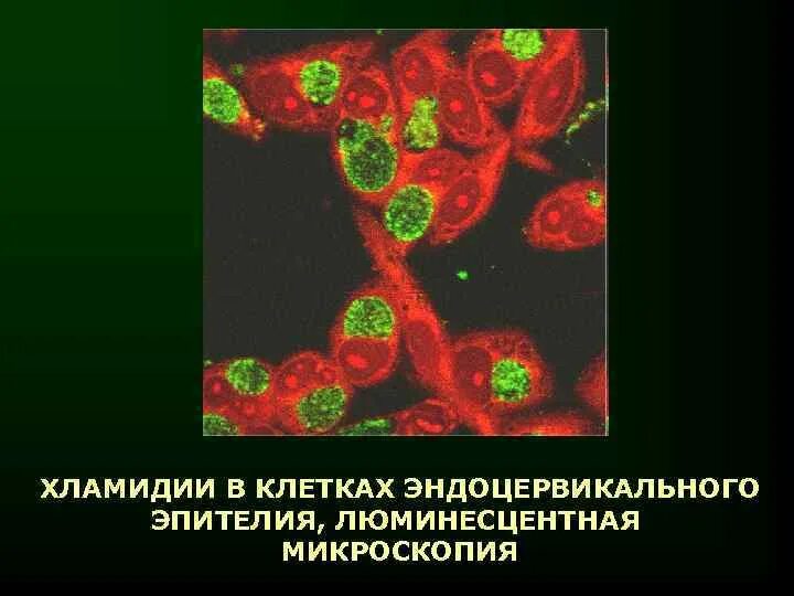 Хламидии люминесцентная микроскопия. Хламидии в эндоцервикальных клетках, люминесцентная микроскопия.. Хламидия пситаци морфология. Пятерка хламидия