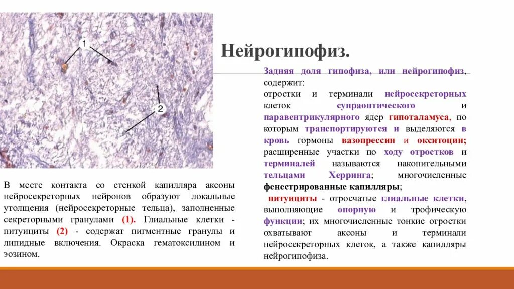 Строение нейрогипофиза гистология. Гипофиз гистологический препарат. Строение задней доли гипофиза гистология. Аденогипофиз гистология препарат.