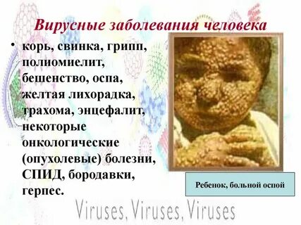 Оспа можно ли заболеть