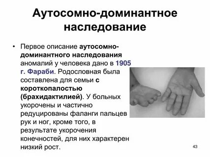 Аутосомно доминантная поликистозная болезнь