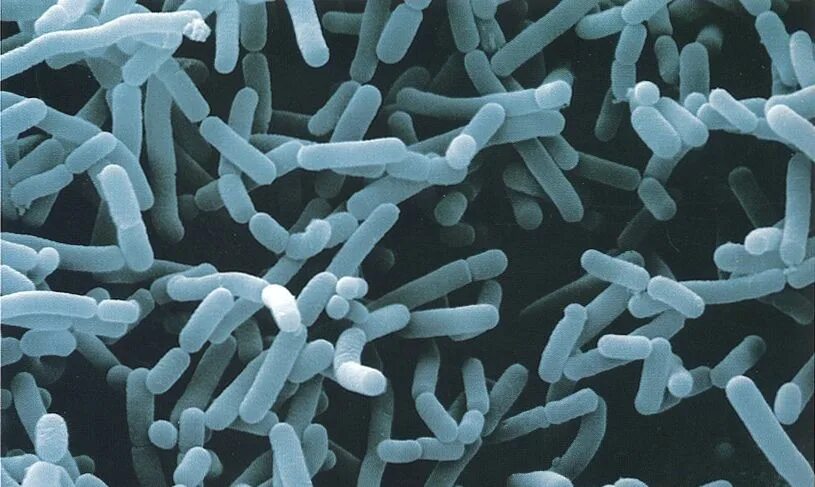 Палочка бифидобактерии. Молочнокислые бактерии лактобациллы. Lactobacillus – (молочнокислые палочки) -. Lactobacillus Acidophilus под микроскопом. Ацидофильные лактобактерии (Lactobacillus Acidophilus).