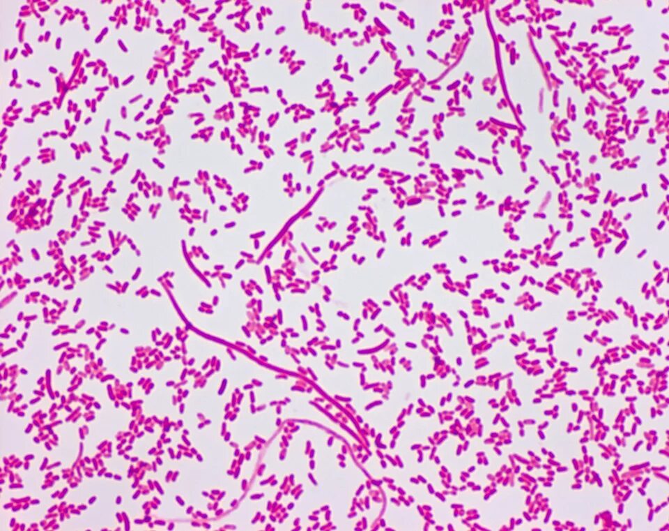 Sneathia spp