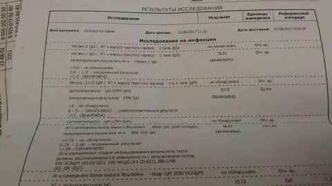 Анализ эпштейн бара
