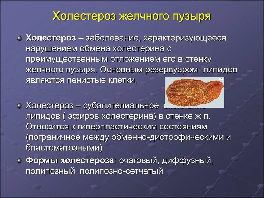 Холестероз стенок желчного пузыря. Холестероз желчного пузыря. Полипозный холестероз желчного пузыря. Холестероз слизистой оболочки желчного пузыря.