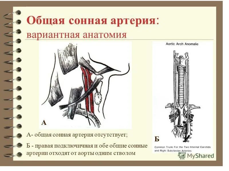 Сонная артерия где находится справа или. Сосуды общей сонной артерии. бифуркация наружной сонной артерии. общая сонная. общая сонная артерия анатомия.