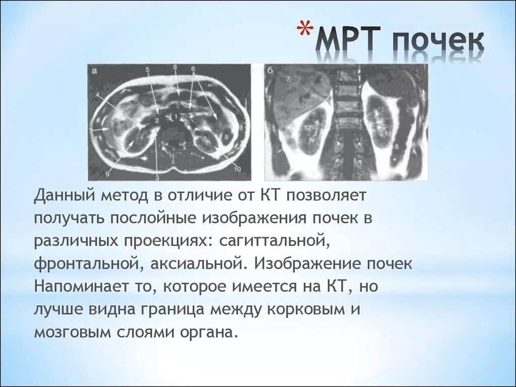 Магнитно-резонансная томография почки опухоль. Компьютерная томография почек с контрастированием. Проекции компьютерной томографии. Кт и мрт почек. Разница кт и кт с контрастом