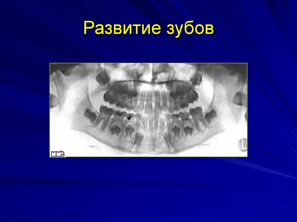 Стадии формирования зачатков зубов. Формирование зачатков молочных зубов. Формирование зуба у человека. Развитие зубов у человека