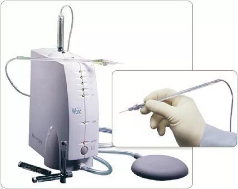 Компьютерный шприц в стоматологии. Компьютерная анестезия в стоматологии. Компьютерная анестезия в стоматологии. Система анестезии compudent sta. Компьютерная анестезия quick sleeper.