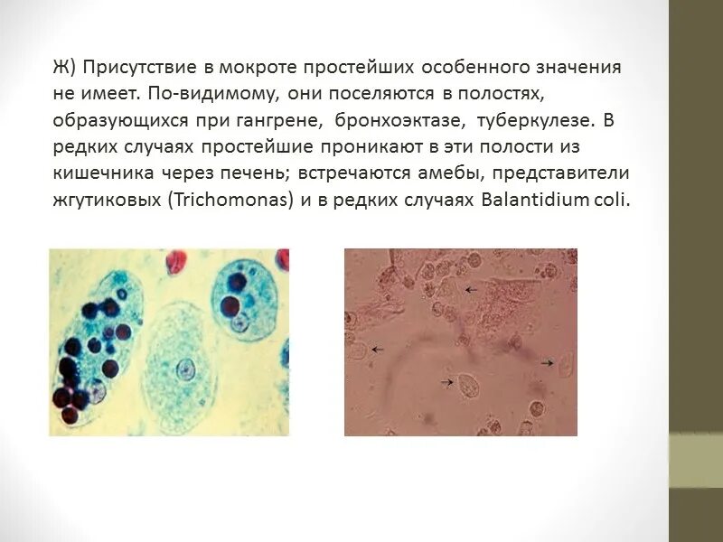 Мокрота по Романовскому Гимзе. Окраска мокроты по Романовскому Гимзе. Клеточные элементы мокроты.