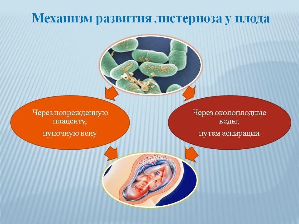 Листериоз лечение у человека. Этиология листериоза. Патогенез листериоза. Симптомы листериоза у человека.