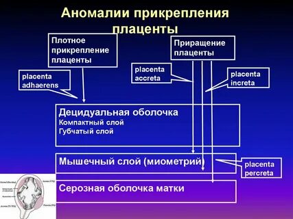 Аномалии плаценты