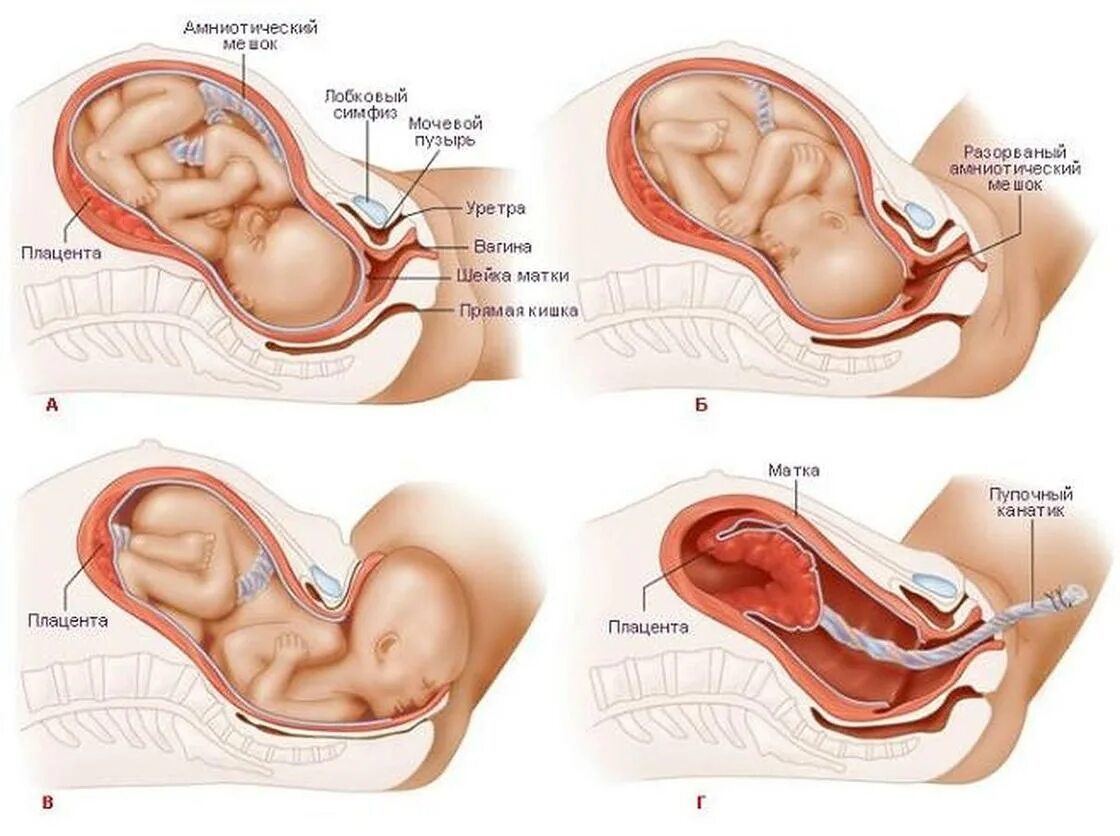 Первые схватки длятся. Процесс рождения ребенка.