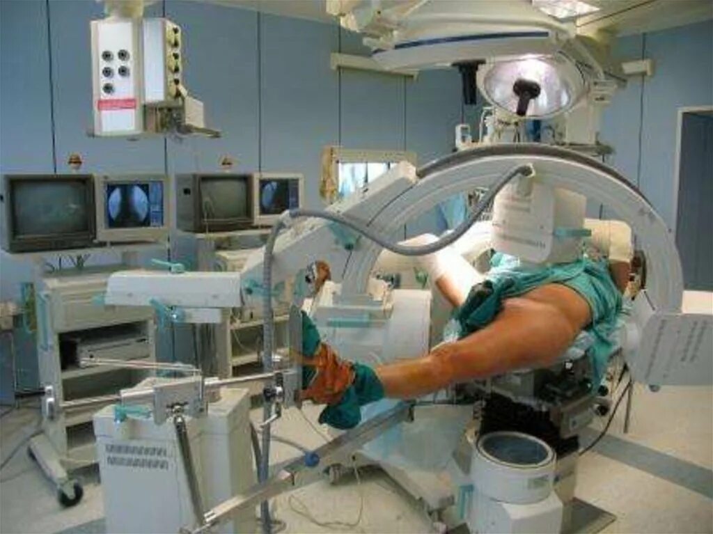 Операционная НИИ Бурденко. ЭОП рентген аппарат. Реанимация Бурденко нейрохирургия. ЭОП рентген в операционной.