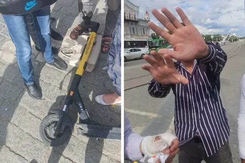 Сбитые самокатчики